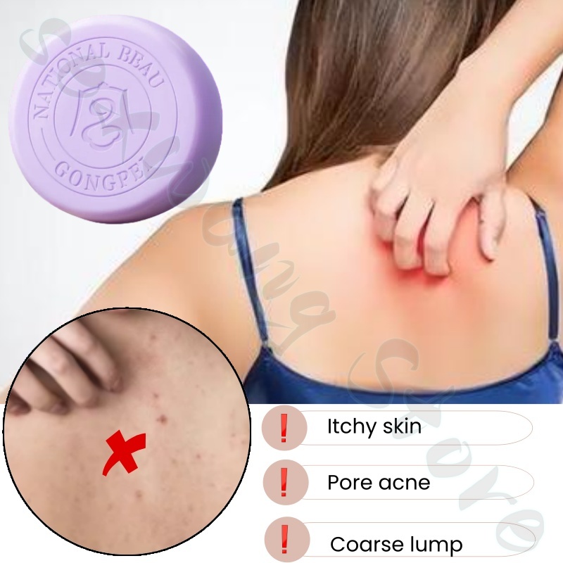 Sabonete com ácido salicílico  - Salicylic Acid Blackhead Remover avaliação e preço