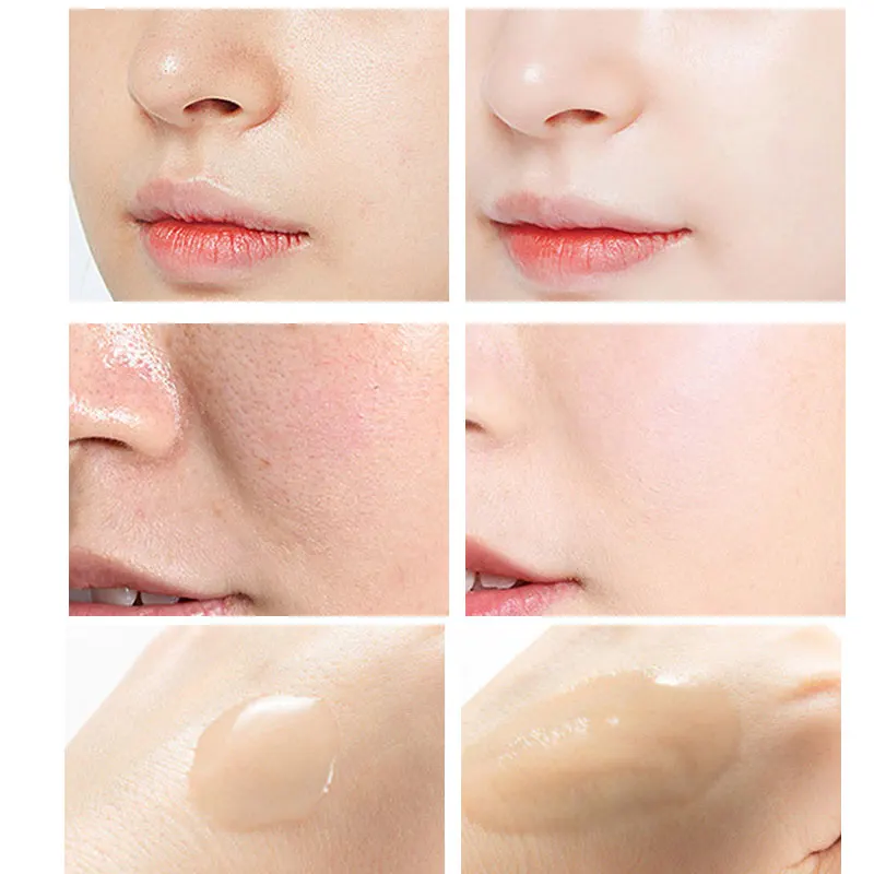 Descamação soro ácido salicíli - Niacinamide Pore Shrinking Essence avaliação e preço